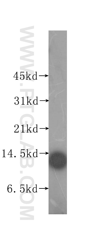 Western Blot (WB) analysis of human heart tissue using MYCBP Polyclonal antibody (12022-1-AP)