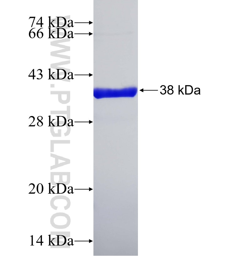 MYCBP fusion protein Ag2651 SDS-PAGE