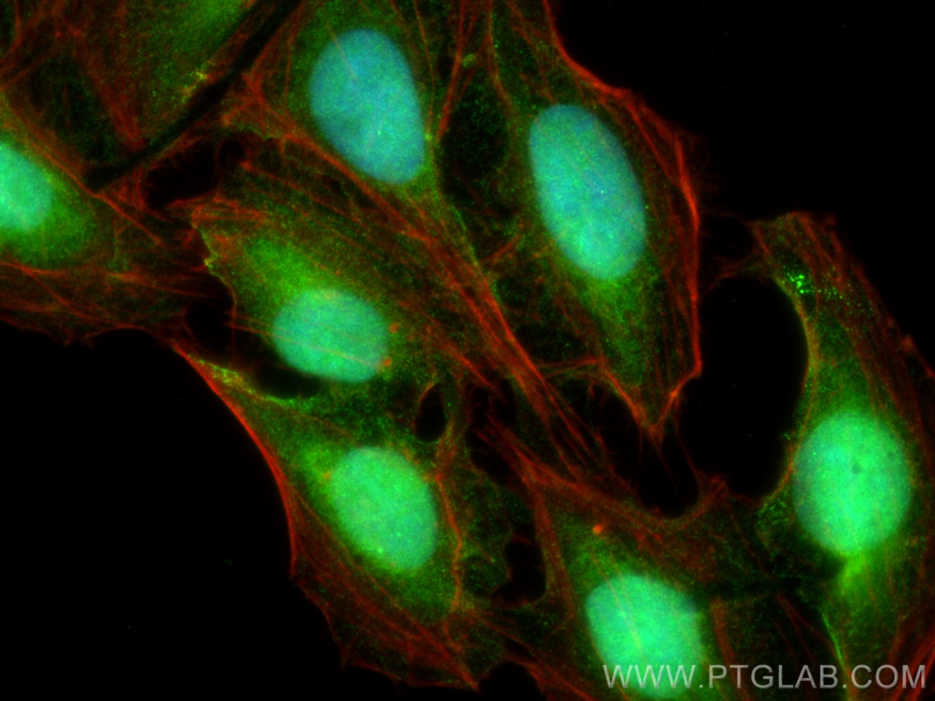 Immunofluorescence (IF) / fluorescent staining of U2OS cells using MYCBP2 Polyclonal antibody (27951-1-AP)