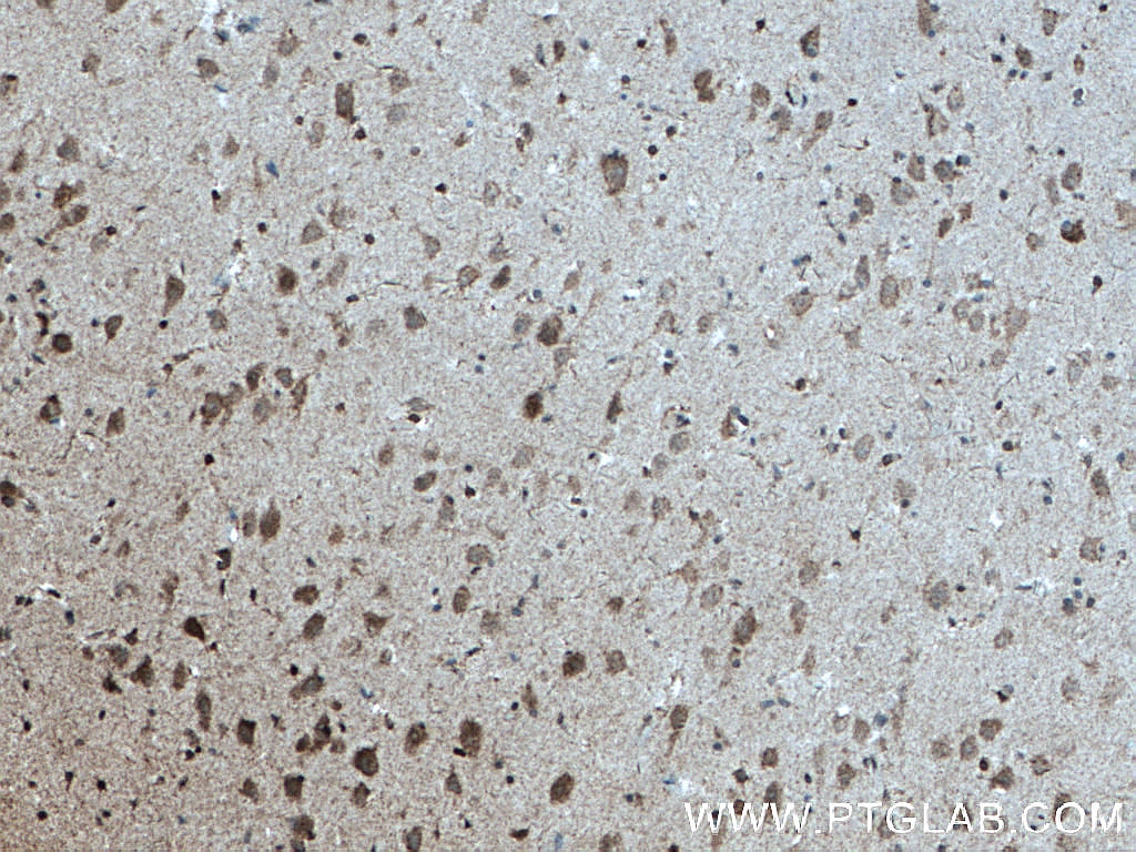 Immunohistochemistry (IHC) staining of human brain tissue using MYCBP2 Polyclonal antibody (27951-1-AP)