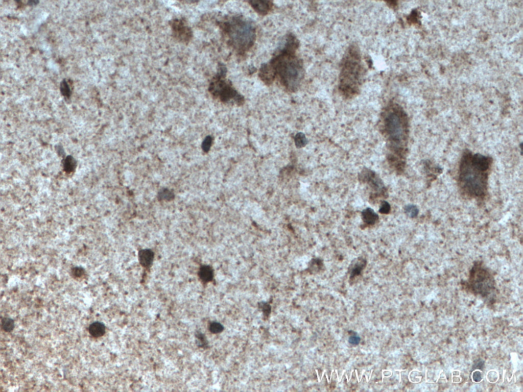 Immunohistochemistry (IHC) staining of human brain tissue using MYCBP2 Polyclonal antibody (27951-1-AP)
