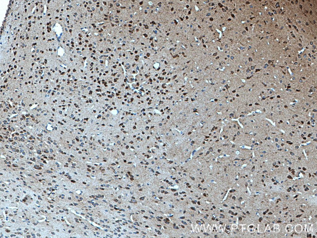 Immunohistochemistry (IHC) staining of mouse brain tissue using MYCBP2 Polyclonal antibody (27951-1-AP)