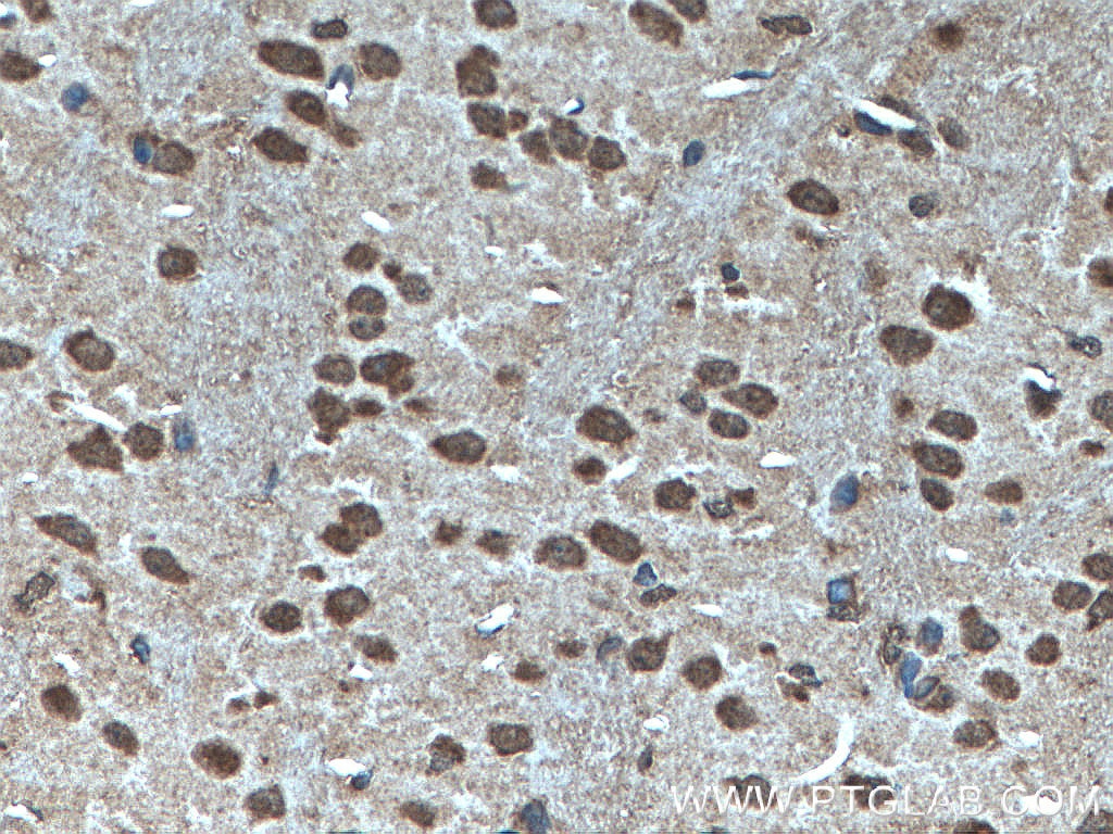 Immunohistochemistry (IHC) staining of mouse brain tissue using MYCBP2 Polyclonal antibody (27951-1-AP)
