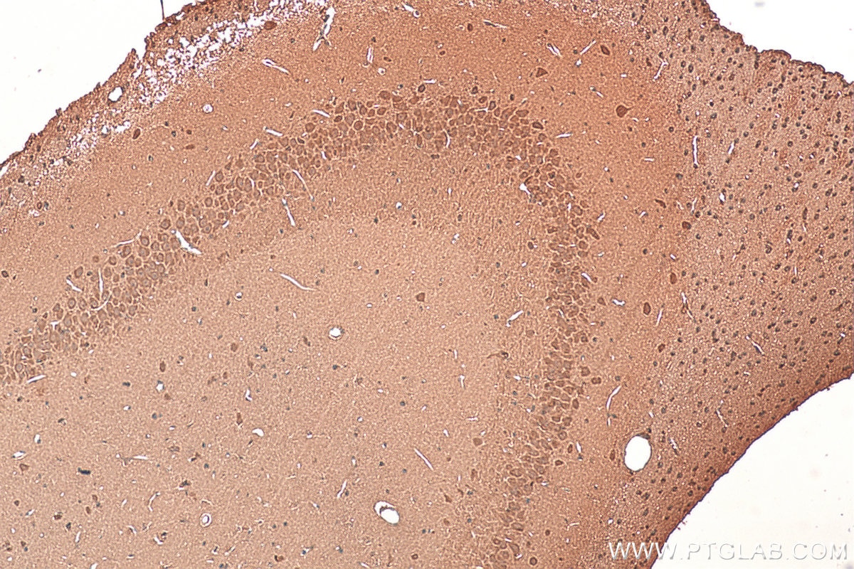 Immunohistochemistry (IHC) staining of rat brain tissue using MYCBP2 Polyclonal antibody (27951-1-AP)