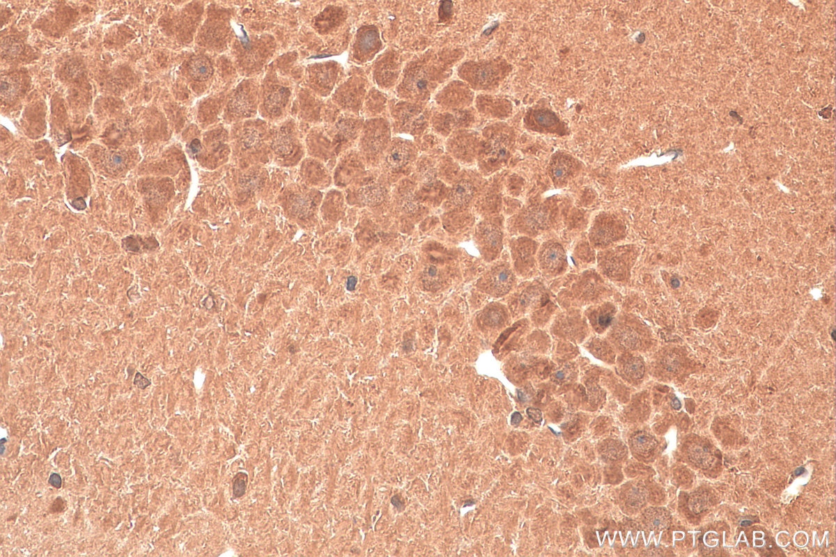 IHC staining of rat brain using 27951-1-AP