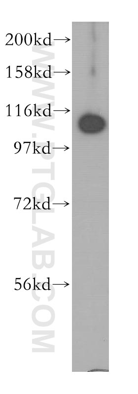 Western Blot (WB) analysis of human placenta tissue using MYCBPAP Polyclonal antibody (12763-1-AP)