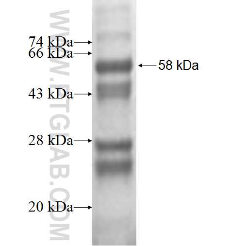 MYCBPAP fusion protein Ag3419 SDS-PAGE