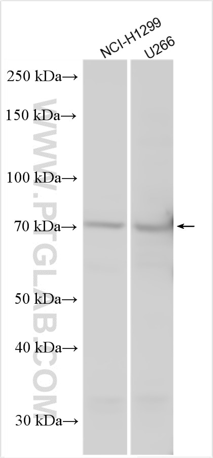 Western Blot (WB) analysis of various lysates using L-Myc Polyclonal antibody (14584-1-AP)
