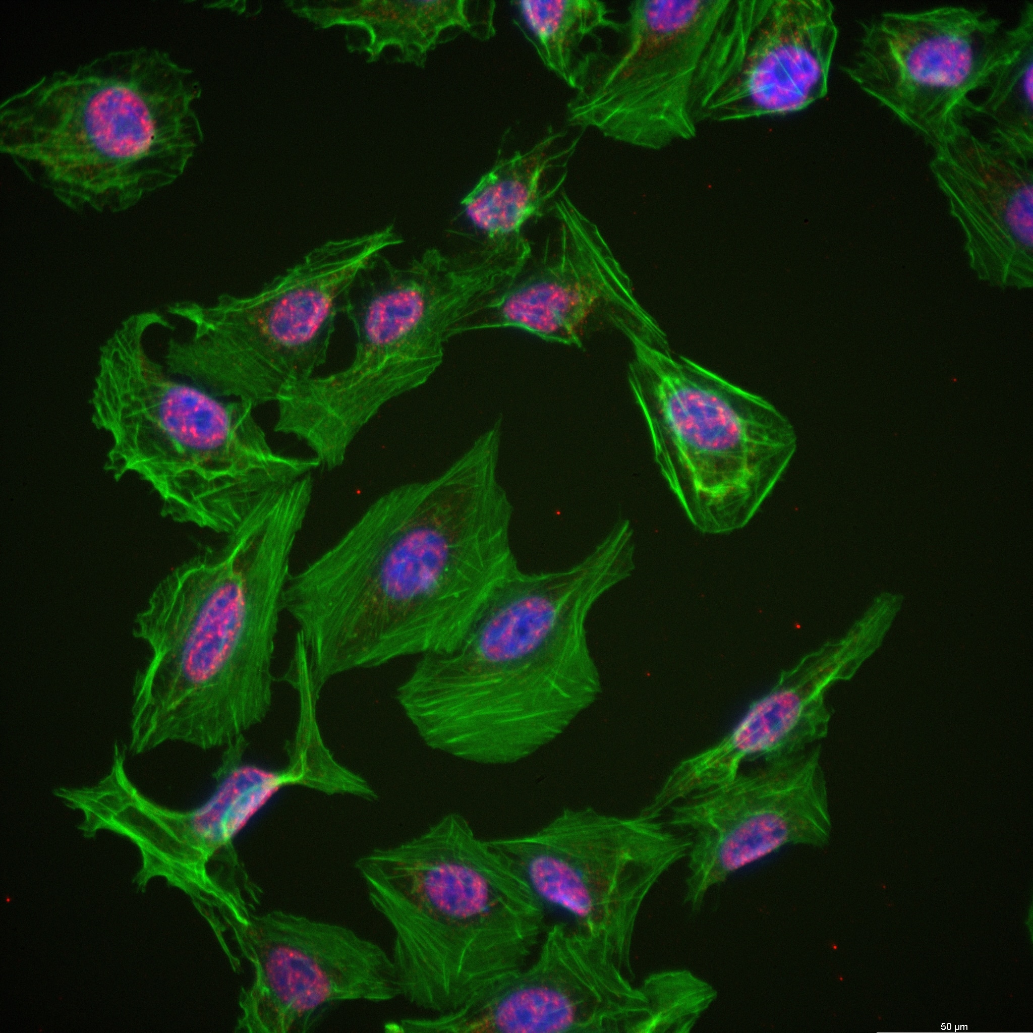 Immunofluorescence (IF) / fluorescent staining of U2OS cells using MYCL1 Recombinant antibody (82881-1-RR)