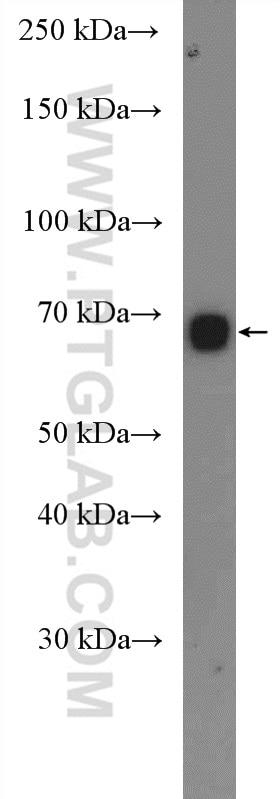 Western Blot (WB) analysis of human placenta tissue using MYCN Polyclonal antibody (10159-2-AP)