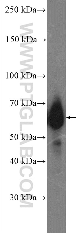 Western Blot (WB) analysis of human placenta tissue using MYCN Polyclonal antibody (10159-2-AP)