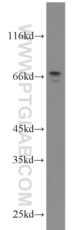 Western Blot (WB) analysis of SKOV-3 cells using MYCN Polyclonal antibody (10159-2-AP)
