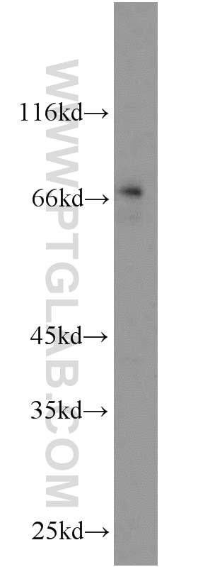 Western Blot (WB) analysis of C6 cells using MYCN Polyclonal antibody (10159-2-AP)