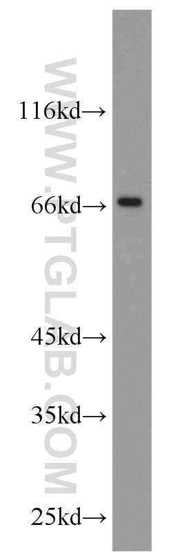 Western Blot (WB) analysis of mouse brain tissue using MYCN Polyclonal antibody (10159-2-AP)