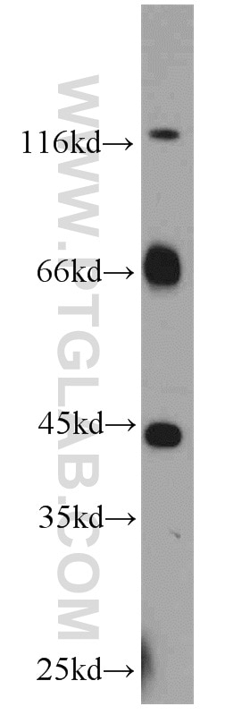 Western Blot (WB) analysis of SH-SY5Y cells using MYCN Polyclonal antibody (10159-2-AP)