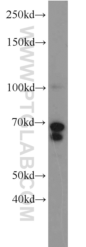 Western Blot (WB) analysis of rat brain tissue using MYCN Polyclonal antibody (10159-2-AP)