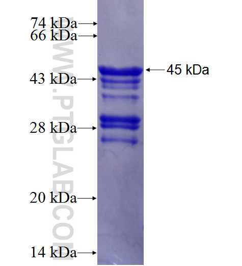 MYCN fusion protein Ag0193 SDS-PAGE