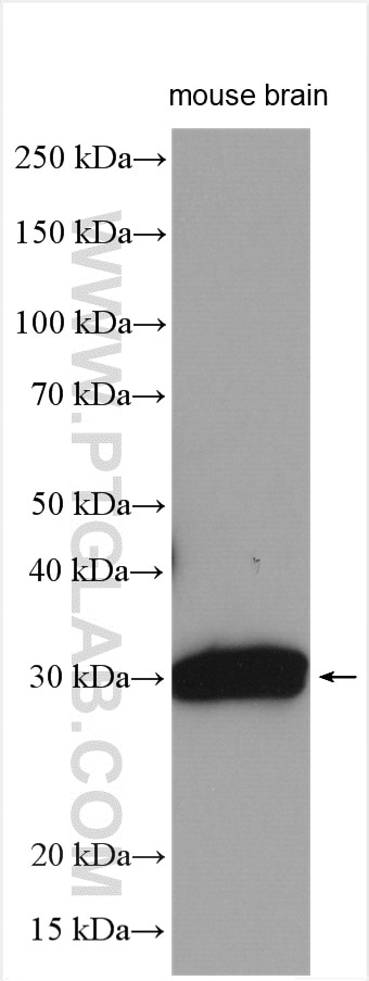 Western Blot (WB) analysis of mouse brain tissue using MYCT1 Polyclonal antibody (22004-1-AP)