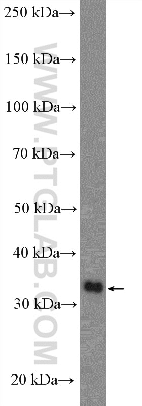 MYD88 Polyclonal antibody