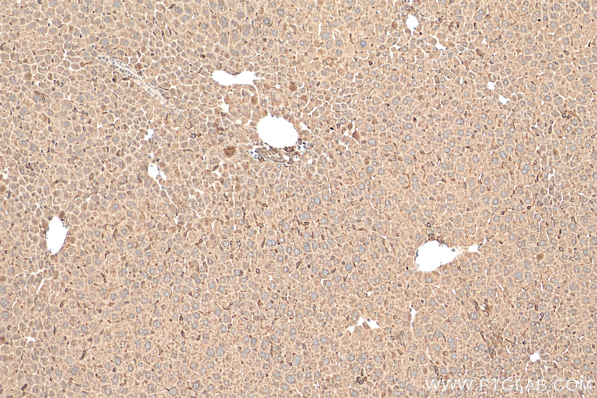 Immunohistochemistry (IHC) staining of mouse liver tissue using MYD88 Polyclonal antibody (29946-1-AP)