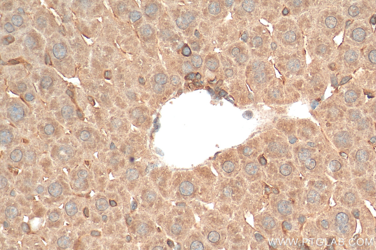 Immunohistochemistry (IHC) staining of mouse liver tissue using MYD88 Polyclonal antibody (29946-1-AP)