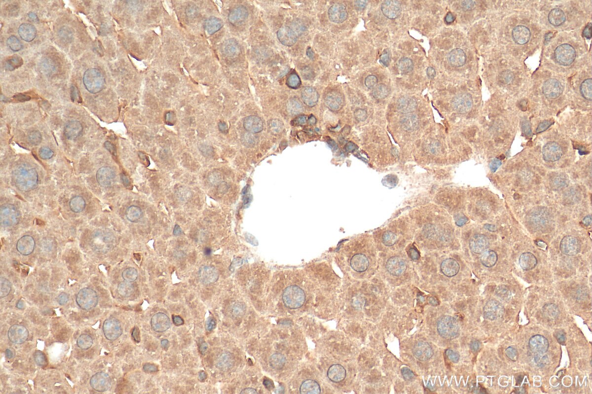 IHC staining of mouse liver using 29946-1-AP