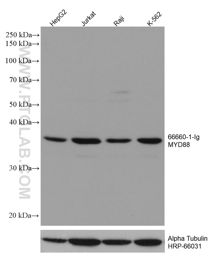 Western Blot (WB) analysis of various lysates using MYD88 Monoclonal antibody (66660-1-Ig)