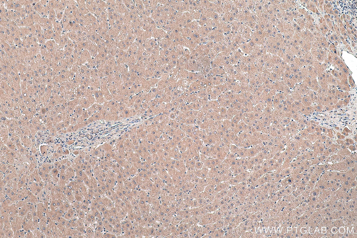 Immunohistochemistry (IHC) staining of human liver tissue using MYD88 Monoclonal antibody (67969-1-Ig)