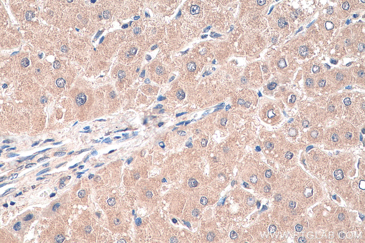 Immunohistochemistry (IHC) staining of human liver tissue using MYD88 Monoclonal antibody (67969-1-Ig)