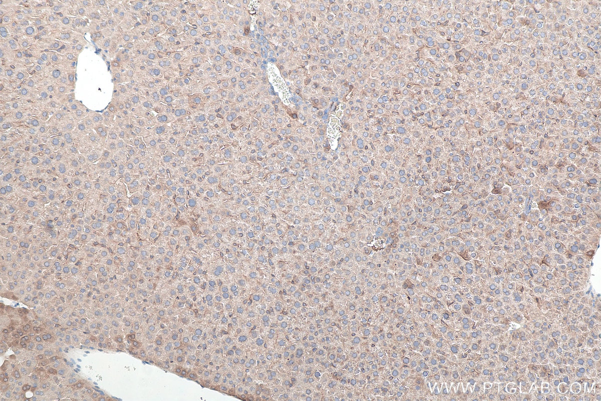 Immunohistochemistry (IHC) staining of mouse liver tissue using MYD88 Monoclonal antibody (67969-1-Ig)