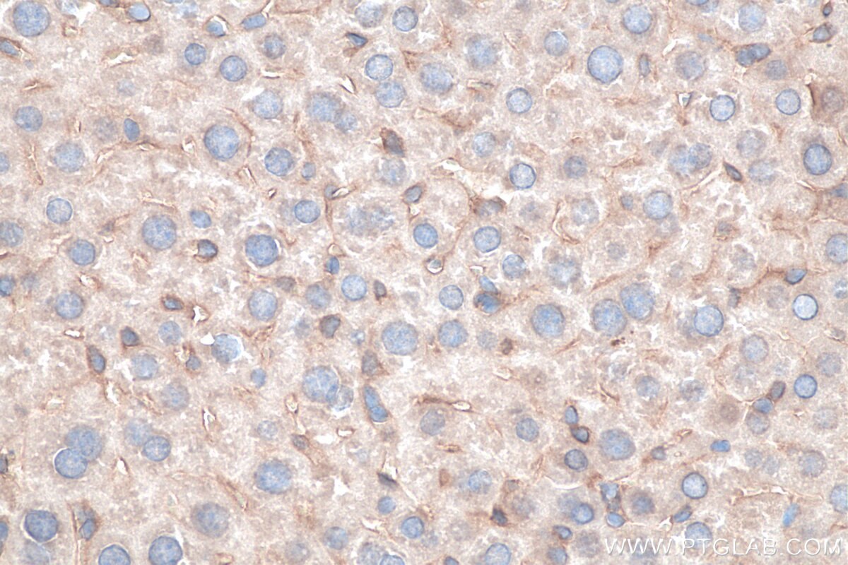 Immunohistochemistry (IHC) staining of mouse liver tissue using MYD88 Monoclonal antibody (67969-1-Ig)