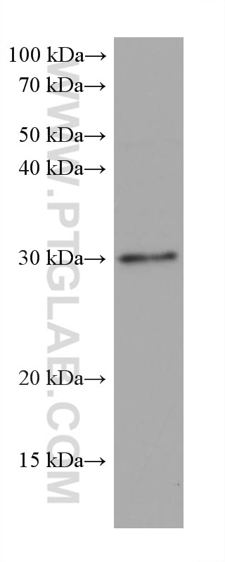 Western Blot (WB) analysis of HSC-T6 cells using MYD88 Monoclonal antibody (67969-1-Ig)