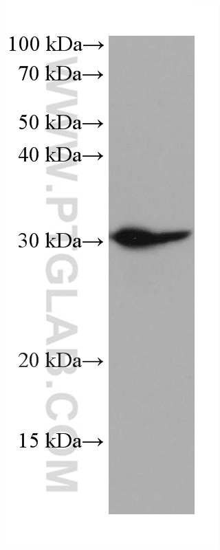 Western Blot (WB) analysis of rabbit spleen tissue using MYD88 Monoclonal antibody (67969-1-Ig)