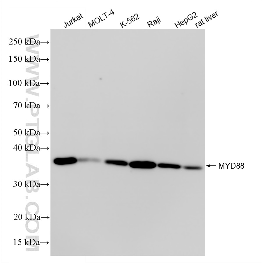 Western Blot (WB) analysis of various lysates using MYD88 Recombinant monoclonal antibody (87040-2-RR)