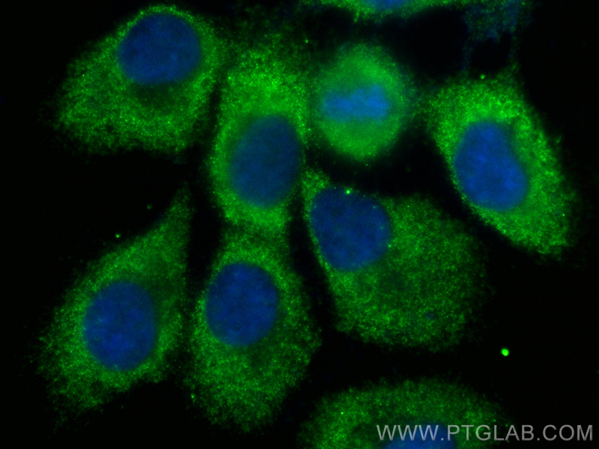 Immunofluorescence (IF) / fluorescent staining of A431 cells using CoraLite® Plus 488-conjugated MYD88 Monoclonal ant (CL488-67969)