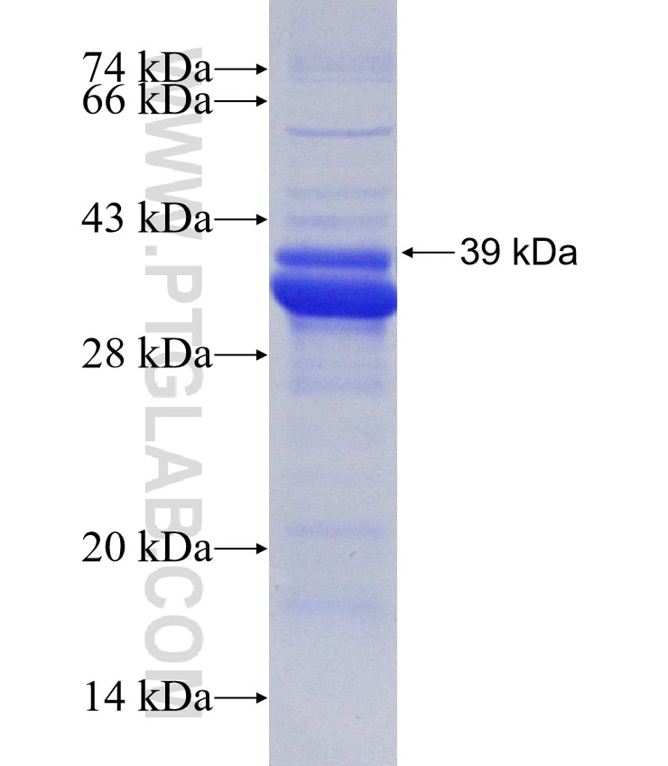 MYD88 fusion protein Ag27659 SDS-PAGE