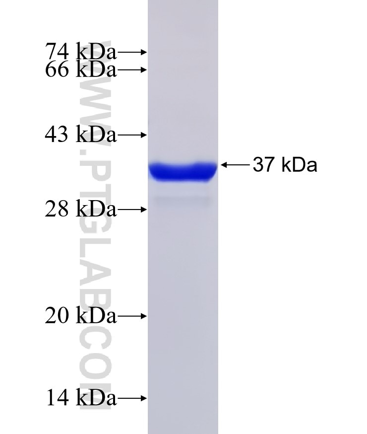 MYD88 fusion protein Ag30662 SDS-PAGE