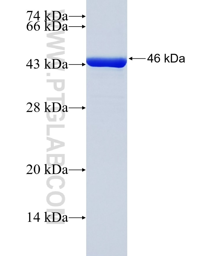 MYD88 fusion protein Ag19770 SDS-PAGE