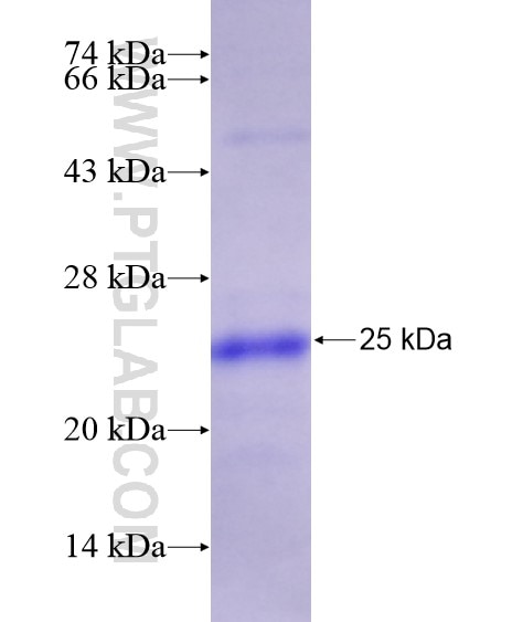 MYD88 fusion protein Ag19782 SDS-PAGE