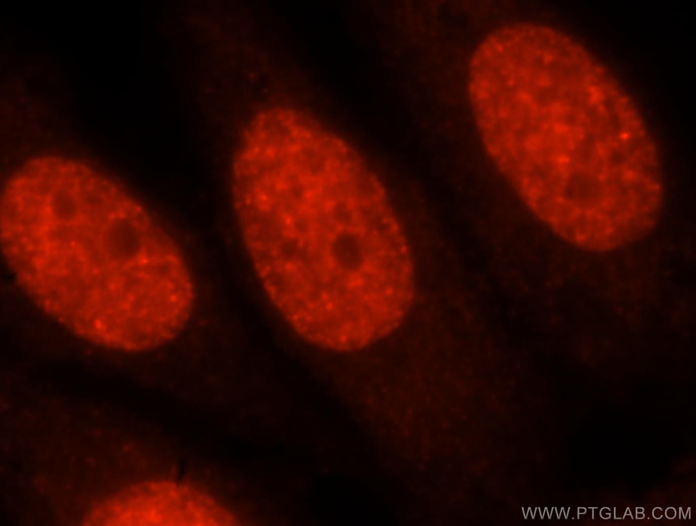 Immunofluorescence (IF) / fluorescent staining of HepG2 cells using MYEF2 Polyclonal antibody (16051-1-AP)
