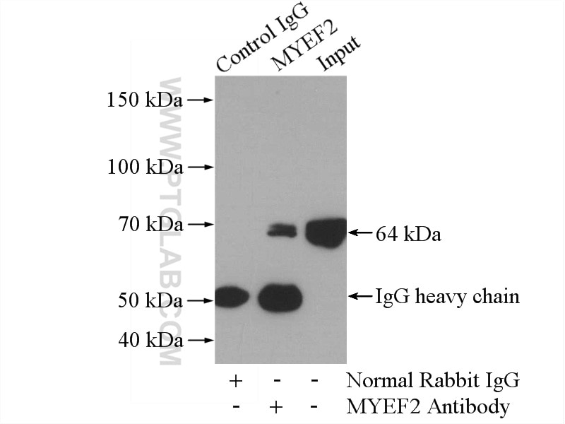 Immunoprecipitation (IP) experiment of Jurkat cells using MYEF2 Polyclonal antibody (16051-1-AP)