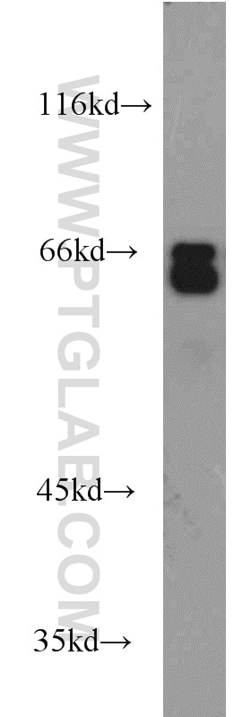 Western Blot (WB) analysis of Jurkat cells using MYEF2 Polyclonal antibody (16051-1-AP)