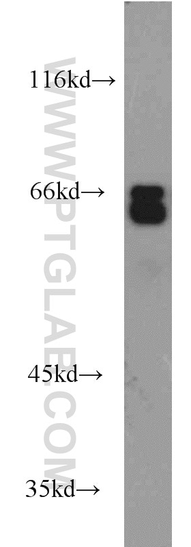 WB analysis of Jurkat using 16051-1-AP