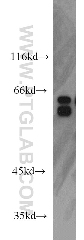 Western Blot (WB) analysis of Jurkat cells using MYEF2 Polyclonal antibody (16051-1-AP)