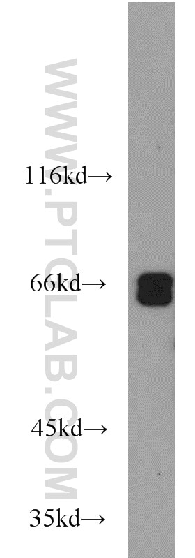 Western Blot (WB) analysis of Jurkat cells using MYEF2 Polyclonal antibody (16051-1-AP)