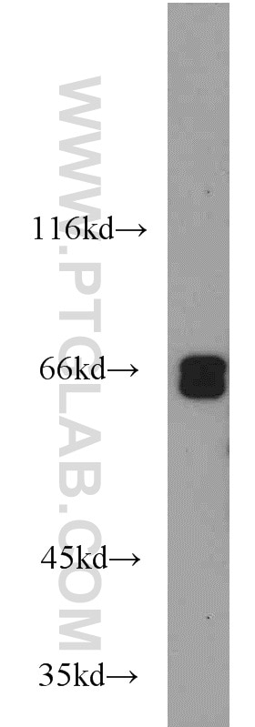 WB analysis of Jurkat using 16051-1-AP