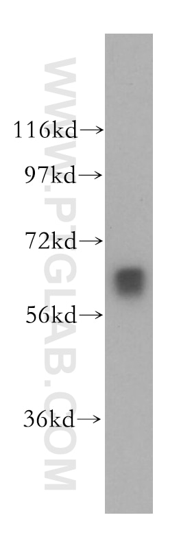 Western Blot (WB) analysis of Jurkat cells using MYEF2 Polyclonal antibody (16051-1-AP)