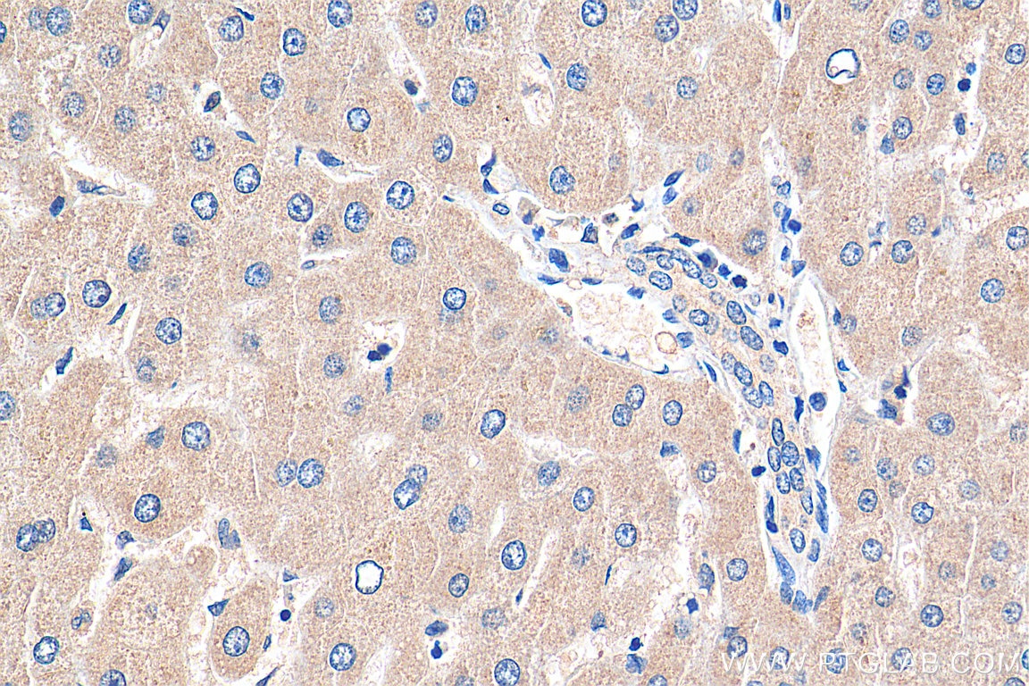 Immunohistochemistry (IHC) staining of human liver tissue using MYEOV Polyclonal antibody (11151-1-AP)