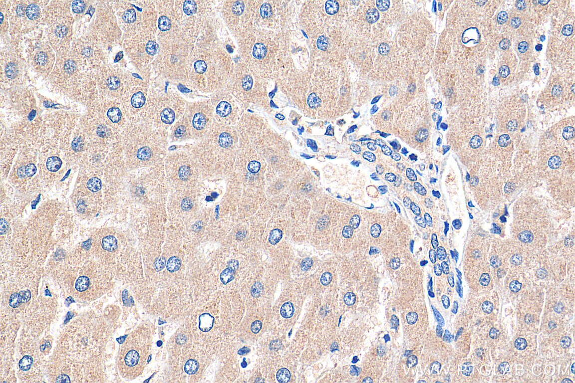 Immunohistochemistry (IHC) staining of human liver tissue using MYEOV Polyclonal antibody (11151-1-AP)