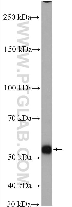 Western Blot (WB) analysis of SGC-7901 cells using MYEOV Polyclonal antibody (11151-1-AP)